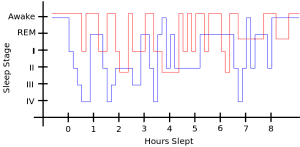 Restless Leg Syndrome - symptoms and remedies