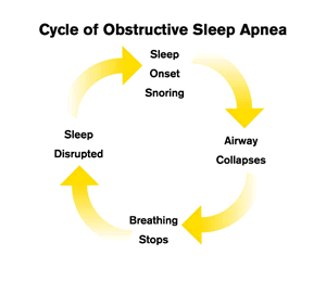 CPAP-How -it -Works